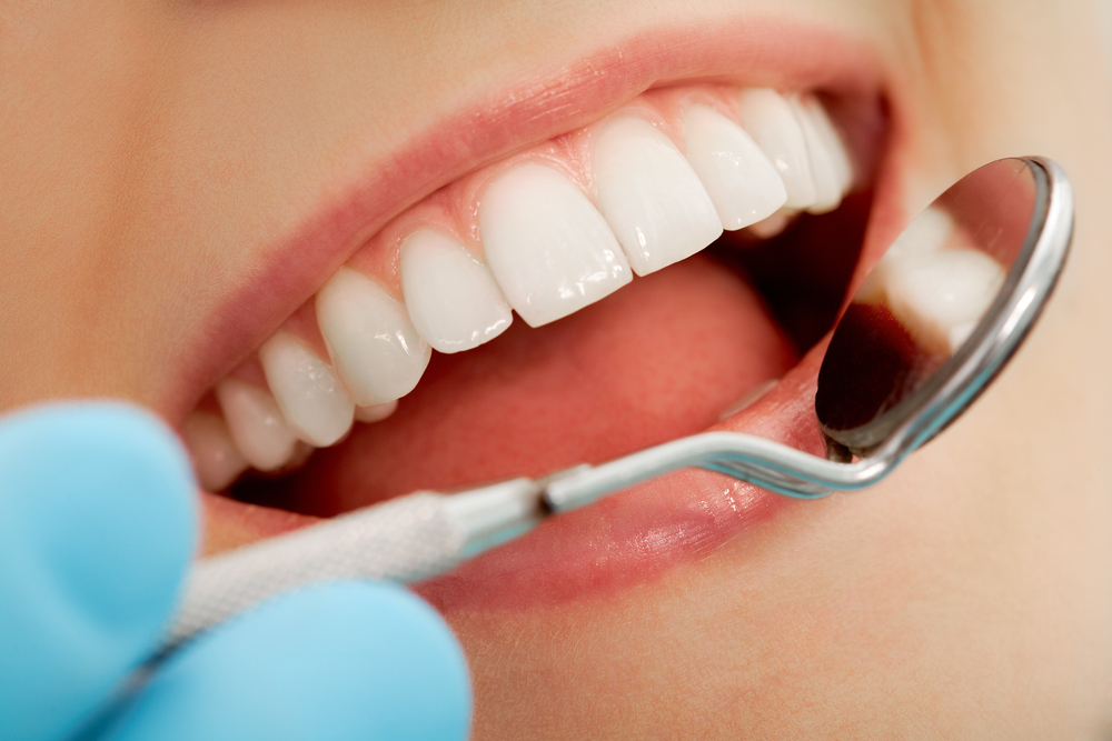 Dental Checkups in urbandale, ia